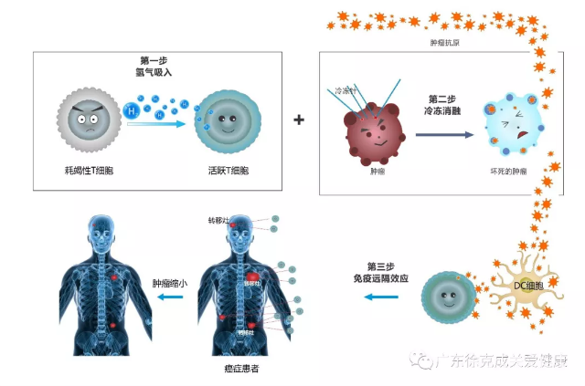 控癌新思路：冷冻消融+吸氢